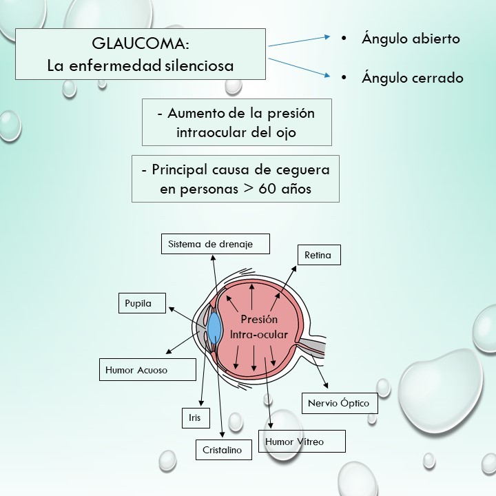 GLAUCOMA, LA ENFERMEDAD SILENCIOSA